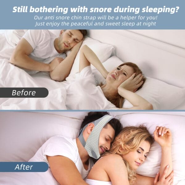 TKVAZK Anti Snore Chin Strap for Sleep - Image 7